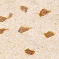PREX1 Rabbit Polyclonal Antibody