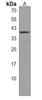 OR52E2 Rabbit Polyclonal Antibody