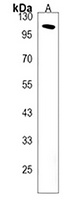 GRIN3B Rabbit Polyclonal Antibody