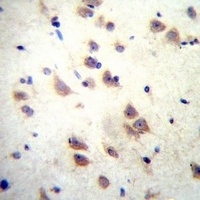 GRIN3B Rabbit Polyclonal Antibody