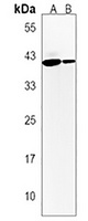CCT alpha Rabbit Polyclonal Antibody