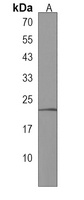 IL-17B Rabbit Polyclonal Antibody