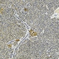 IL-17B Rabbit Polyclonal Antibody