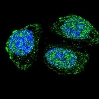 IL-17B Rabbit Polyclonal Antibody