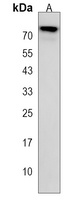 OTOP1 Rabbit Polyclonal Antibody