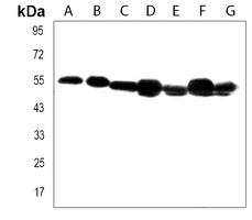 TUBB6 Rabbit Polyclonal Antibody