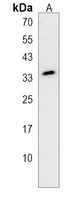 STARD6 Rabbit Polyclonal Antibody