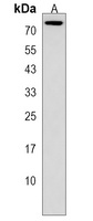 CCDC63 Rabbit Polyclonal Antibody