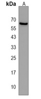 SMTNL1 Rabbit Polyclonal Antibody
