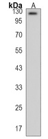 SCUBE2 Rabbit Polyclonal Antibody