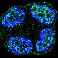 SCUBE2 Rabbit Polyclonal Antibody