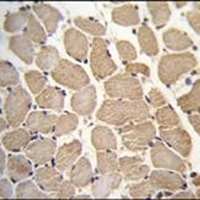 GAS2L2 Rabbit Polyclonal Antibody