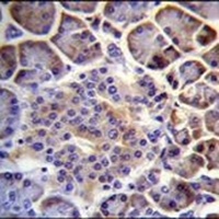 PTCHD4 Rabbit Polyclonal Antibody
