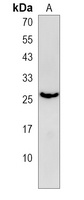 EMC7 Rabbit Polyclonal Antibody
