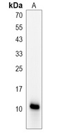 CGRP-1 Rabbit Polyclonal Antibody