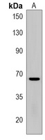 TGM6 Rabbit Polyclonal Antibody
