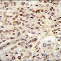 TGM6 Rabbit Polyclonal Antibody