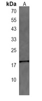 IQCJ Rabbit Polyclonal Antibody