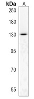 TLL1 Rabbit Polyclonal Antibody