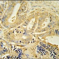 TLL1 Rabbit Polyclonal Antibody