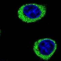 AMY2B Rabbit Polyclonal Antibody