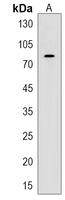 ATF7IP2 Rabbit Polyclonal Antibody