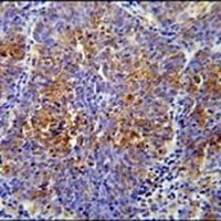 ATF7IP2 Rabbit Polyclonal Antibody