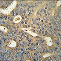 MICALL1 Rabbit Polyclonal Antibody