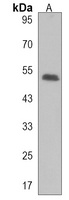 DENND1B Rabbit Polyclonal Antibody
