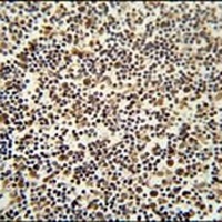 DENND1B Rabbit Polyclonal Antibody