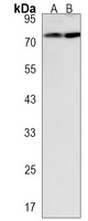 NSUN7 Rabbit Polyclonal Antibody
