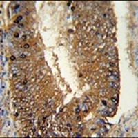 NSUN7 Rabbit Polyclonal Antibody