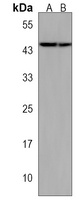 TFB2M Rabbit Polyclonal Antibody