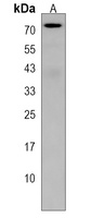 RFT1 Rabbit Polyclonal Antibody