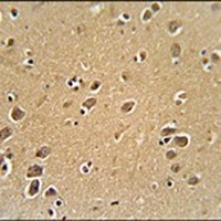 RFT1 Rabbit Polyclonal Antibody