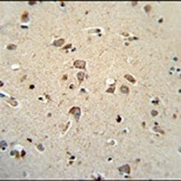 NIPAL4 Rabbit Polyclonal Antibody