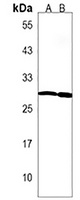 LAPTM5 Rabbit Polyclonal Antibody