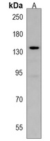 POTEE Rabbit Polyclonal Antibody