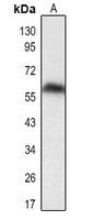 DUSP8 Rabbit Polyclonal Antibody