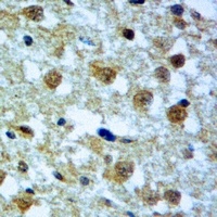 DUSP8 Rabbit Polyclonal Antibody