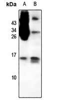 CCL1 Rabbit Polyclonal Antibody