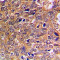 ABL1/2 (Phospho-Y393/439) Rabbit Polyclonal Antibody