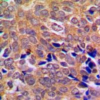 ABL1/2 Rabbit Polyclonal Antibody