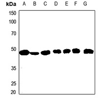 ACAT1 Rabbit Polyclonal Antibody