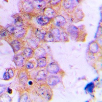 ACAT1 Rabbit Polyclonal Antibody