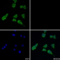 ACAT1 Rabbit Polyclonal Antibody