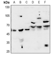 Acetylcholinesterase Rabbit Polyclonal Antibody