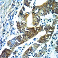 Acetylcholinesterase Rabbit Polyclonal Antibody
