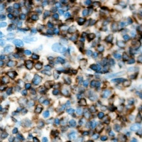 ACVR1B Rabbit Polyclonal Antibody