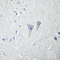 Adenosine A2a Receptor Rabbit Polyclonal Antibody